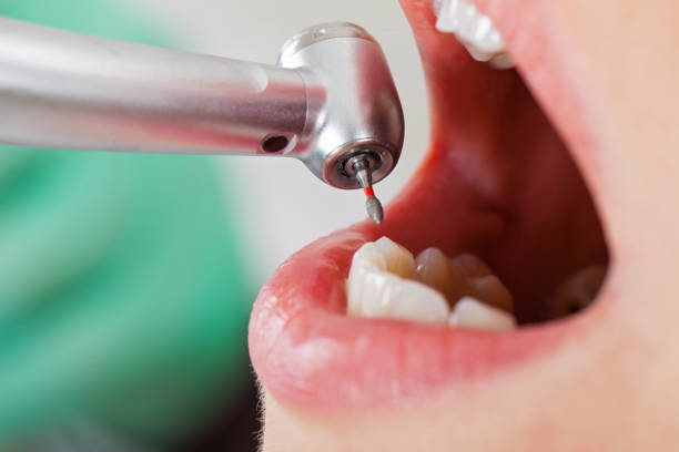 Best Emergency Dentist for Knocked-Out Tooth in Panora, IA